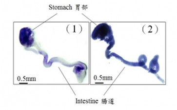 香港大學李嘉誠醫(yī)學院發(fā)現影響腸神經細胞發(fā)育的新基因變異